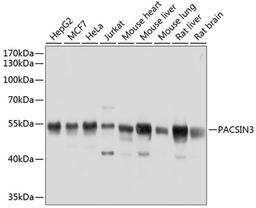 Western blot - PACSIN3 antibody (A8647)