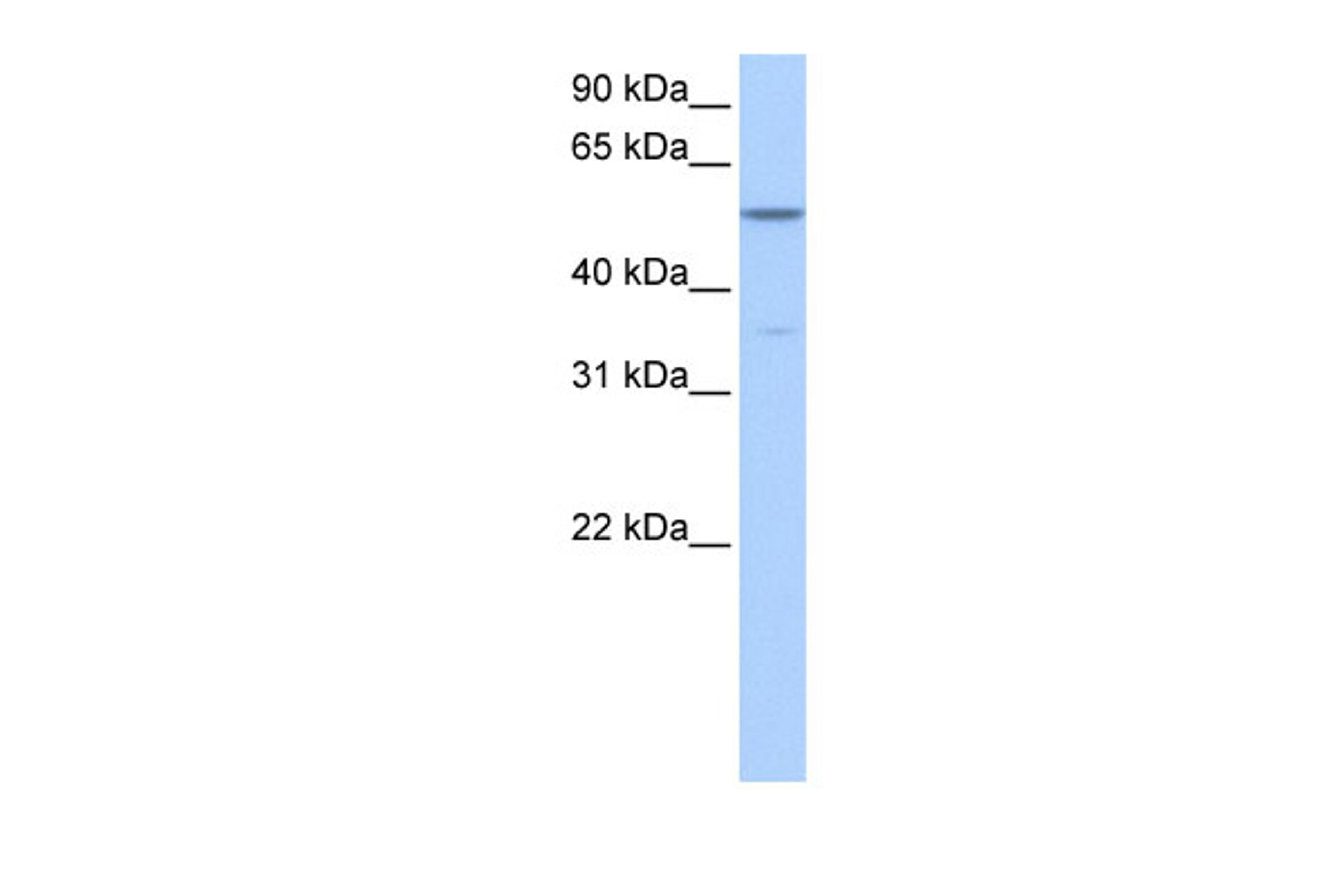 Antibody used in WB on Human Liver at 0.2-1 ug/ml.