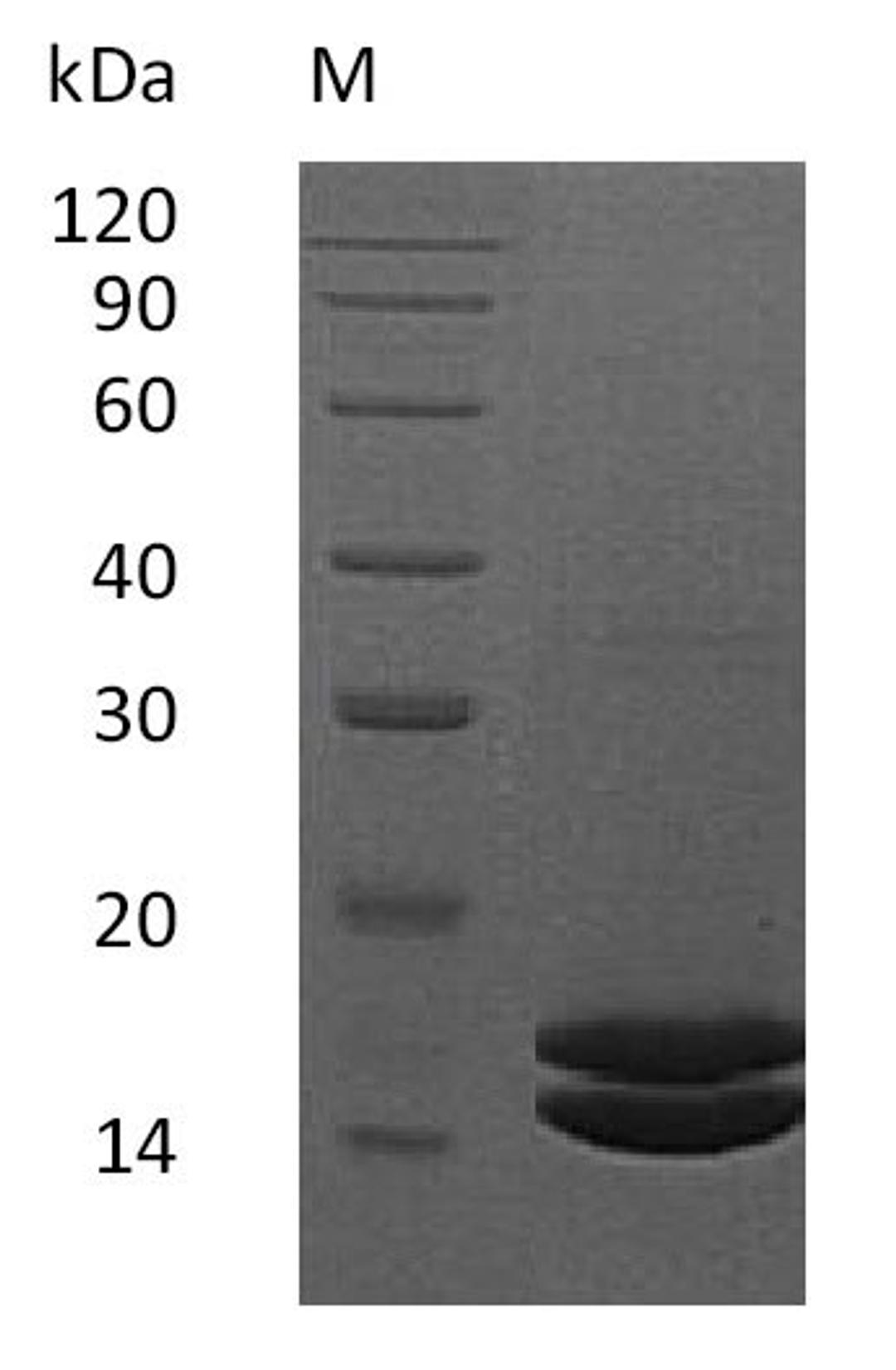 (Tris-Glycine gel) Discontinuous SDS-PAGE (reduced) with 5% enrichment gel and 15% separation gel.
