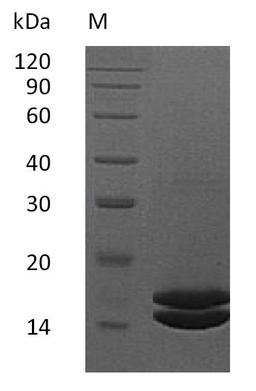 (Tris-Glycine gel) Discontinuous SDS-PAGE (reduced) with 5% enrichment gel and 15% separation gel.