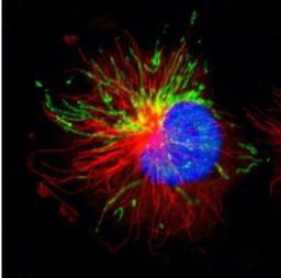 Immunofluorescence: LONP1 Antibody [NBP1-81734] - Staining of human cell line U-251 MG shows positivity in mitochondria. Antibody staining is shown in green.