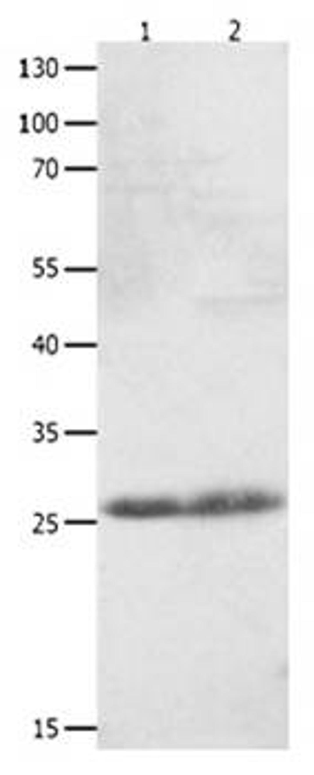 Western blot analysis of Human fetal kidney tissue, Jurkat cell lysate(30ug) at:1:1100 dilution using CLEC4D antibody