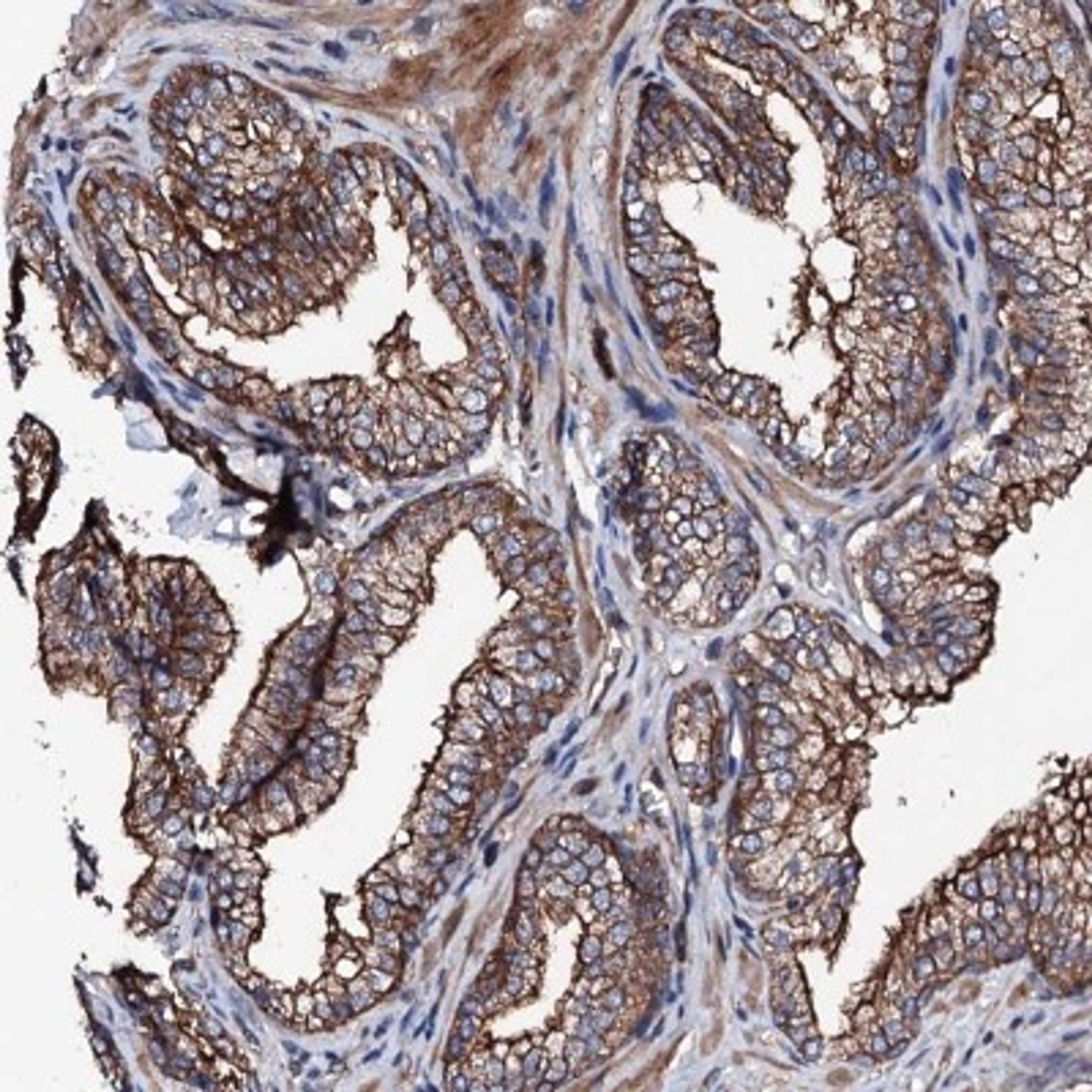 Immunohistochemistry-Paraffin: LRRC35 Antibody [NBP2-34051] - Immunohistochemical staining of human prostate shows strong cytoplasmic and membranous positivity in glandular cells.