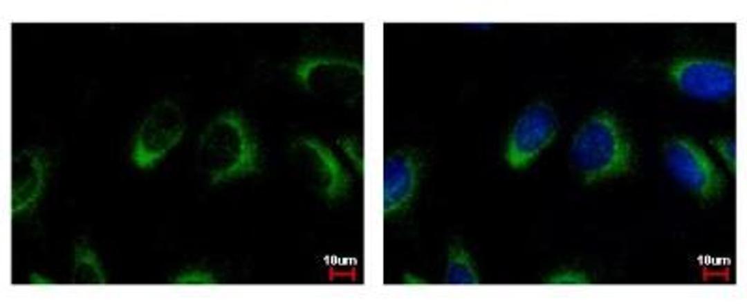 Immunocytochemistry/Immunofluorescence: NQO-2 Antibody [NBP1-31563] - Sample: HeLa cells were fixed in 4% paraformaldehyde at RT for 15 min. Green: NQO2 protein stained by NQO2 antibody diluted at 1:500. Blue: Hoechst 33342 staining.