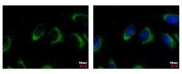 Immunocytochemistry/Immunofluorescence: NQO-2 Antibody [NBP1-31563] - Sample: HeLa cells were fixed in 4% paraformaldehyde at RT for 15 min. Green: NQO2 protein stained by NQO2 antibody diluted at 1:500. Blue: Hoechst 33342 staining.