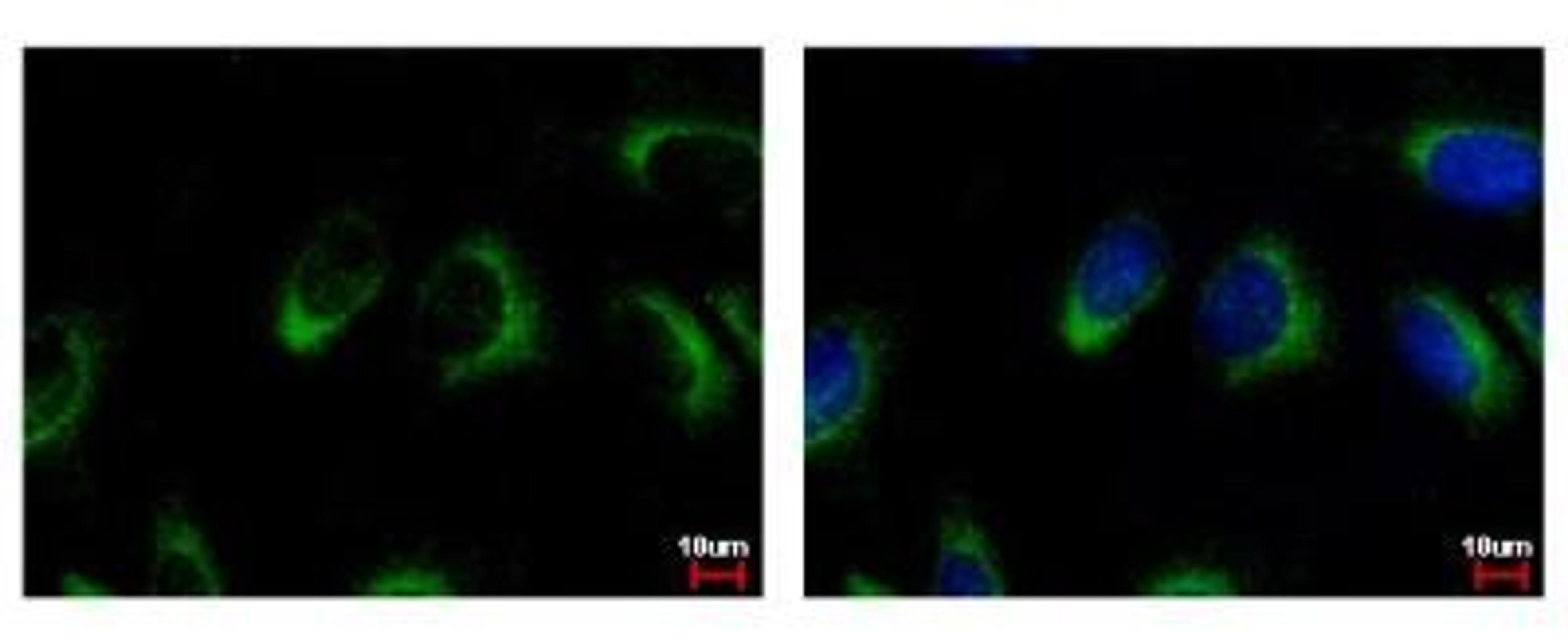 Immunocytochemistry/Immunofluorescence: NQO-2 Antibody [NBP1-31563] - Sample: HeLa cells were fixed in 4% paraformaldehyde at RT for 15 min. Green: NQO2 protein stained by NQO2 antibody diluted at 1:500. Blue: Hoechst 33342 staining.