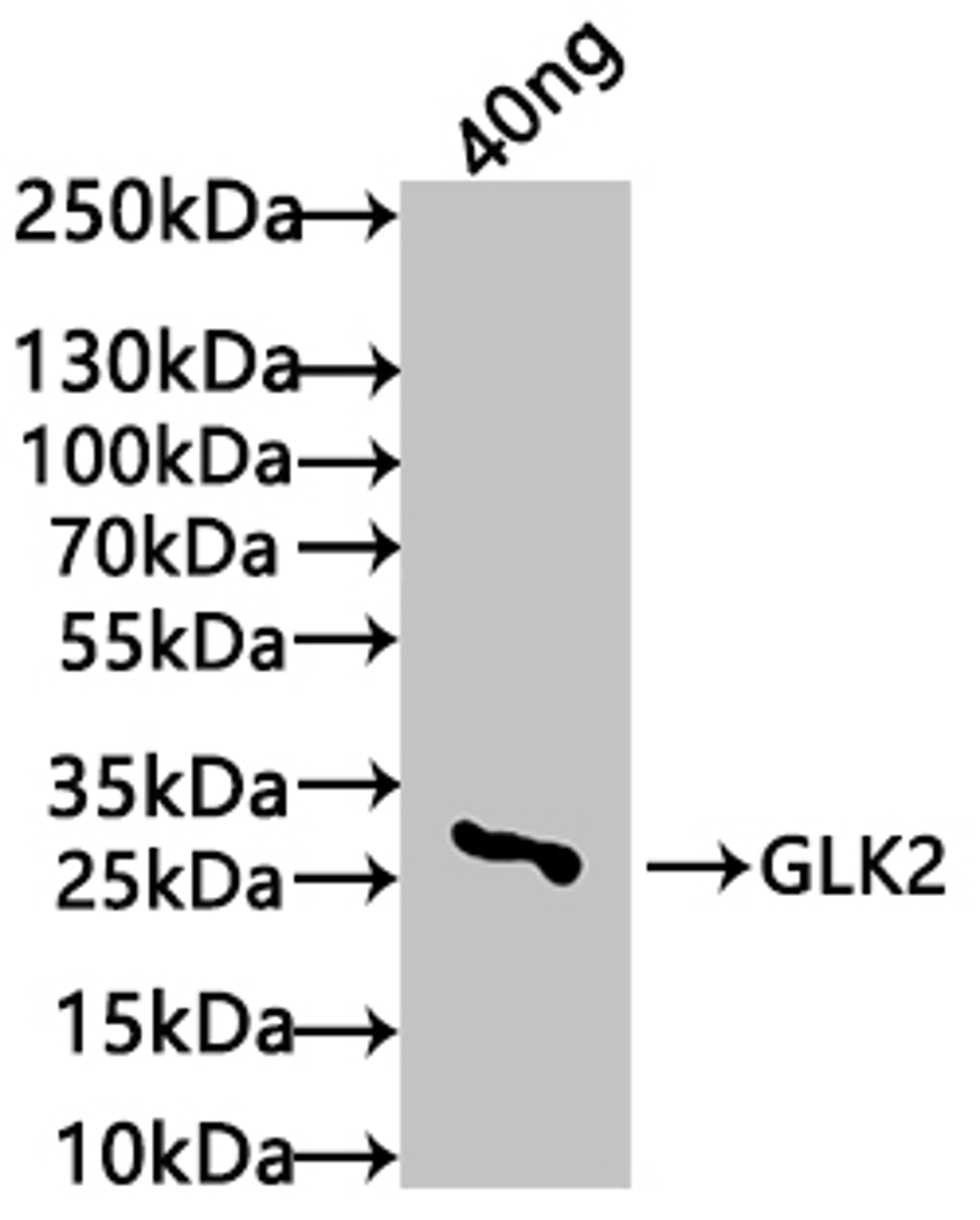 Western Blot. Positive WB detected in: recombinant protein. All lanes: GLK2 Antibody at 1:1000. Secondary. Goat polyclonal to rabbit IgG at 1/50000 dilution. Predicted band size: 25 kDa. Observed band size: 27 kDa. 