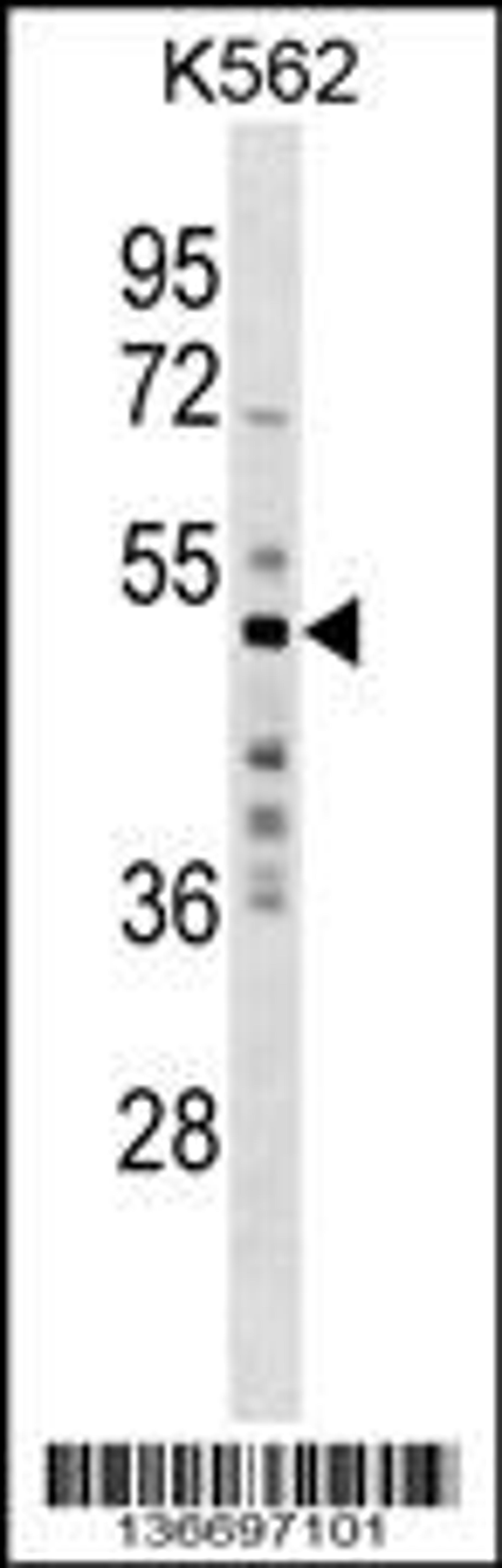 Western blot analysis in K562 cell line lysates (35ug/lane).