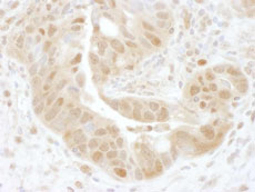 Detection of human PSMD7 by immunohistochemistry.