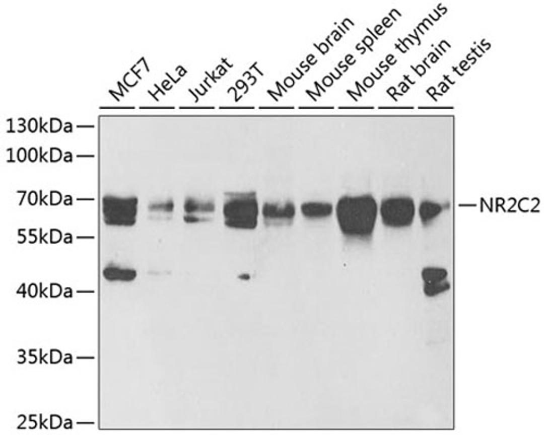 Western blot - NR2C2 antibody (A6422)