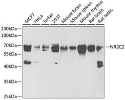 Western blot - NR2C2 antibody (A6422)