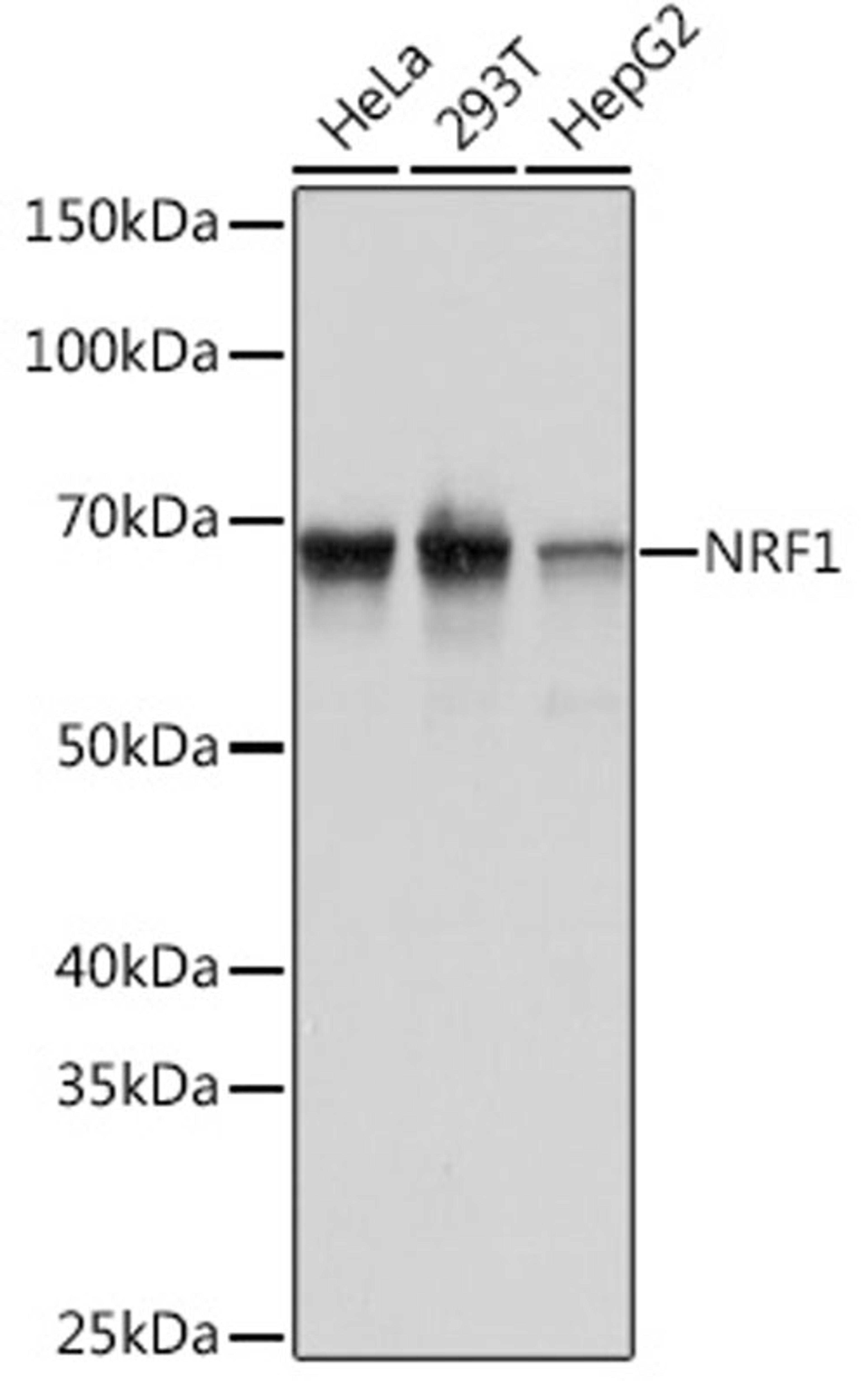 Western blot - NRF1 Rabbit mAb (A3252)