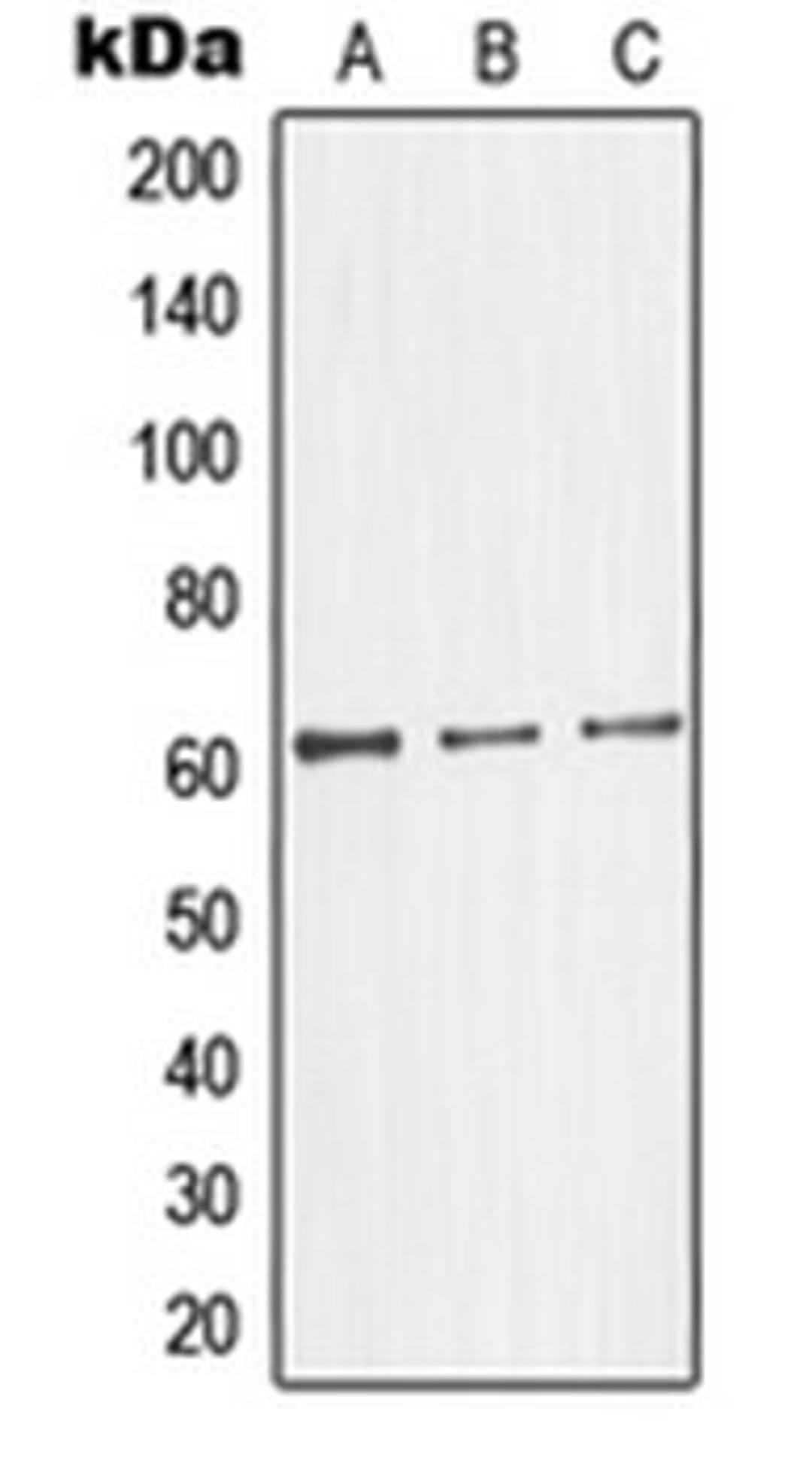 Western blot analysis of HepG2 (Lane 1), HeLa (Lane 2), Jurkat (Lane 3) whole cell lysates using GK2 antibody