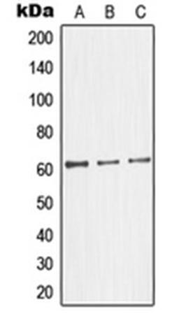 Western blot analysis of HepG2 (Lane 1), HeLa (Lane 2), Jurkat (Lane 3) whole cell lysates using GK2 antibody