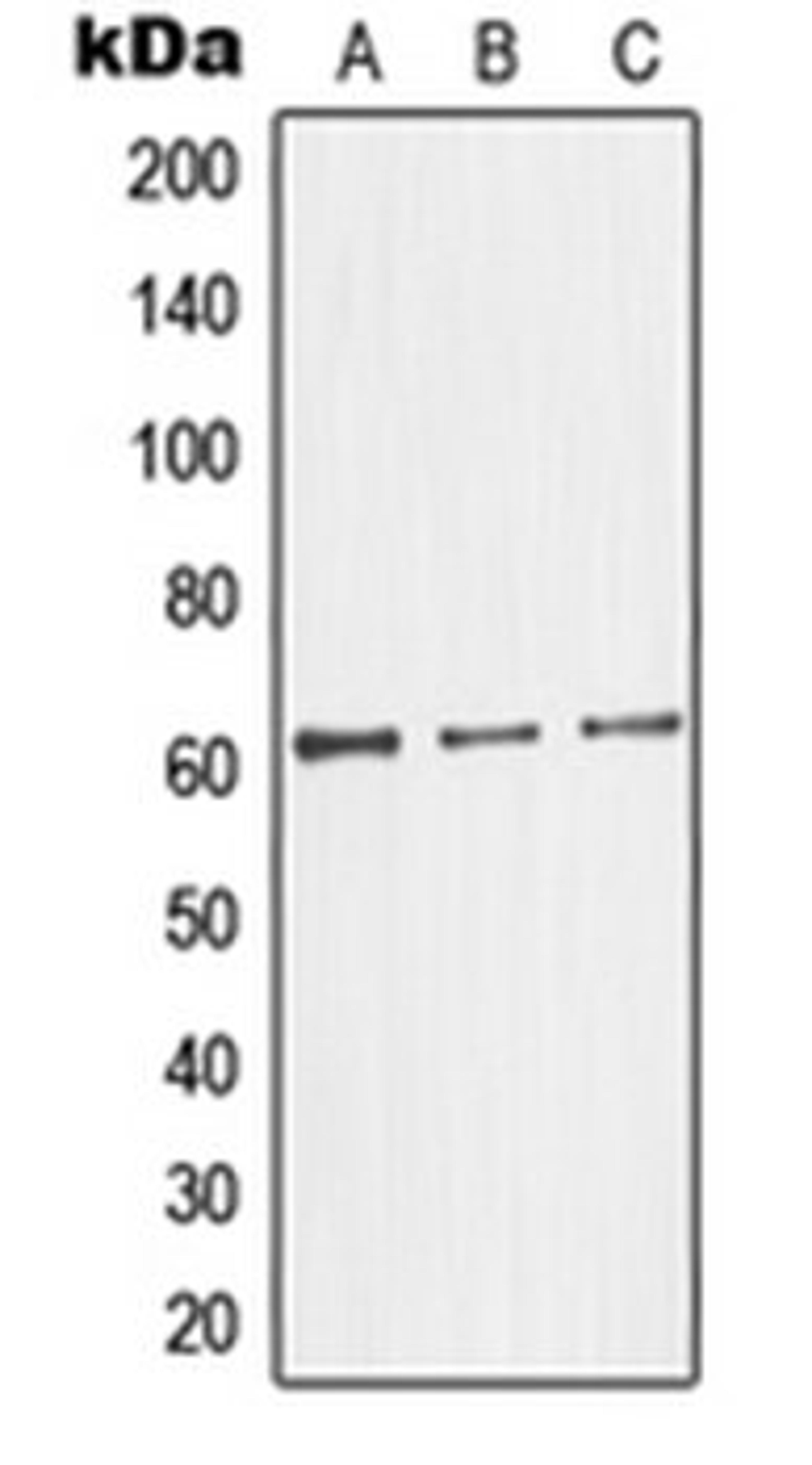 Western blot analysis of HepG2 (Lane 1), HeLa (Lane 2), Jurkat (Lane 3) whole cell lysates using GK2 antibody