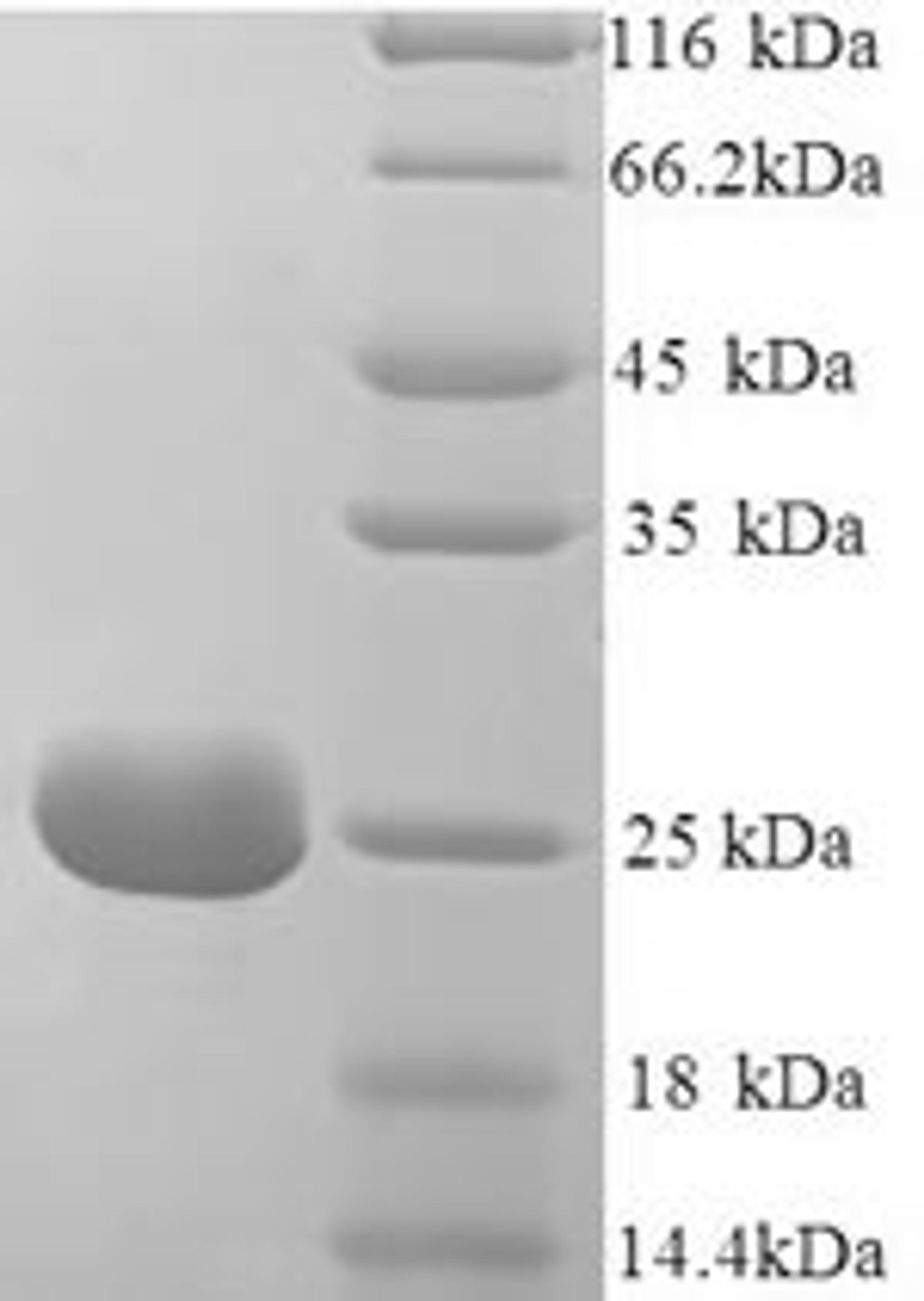 (Tris-Glycine gel) Discontinuous SDS-PAGE (reduced) with 5% enrichment gel and 15% separation gel.