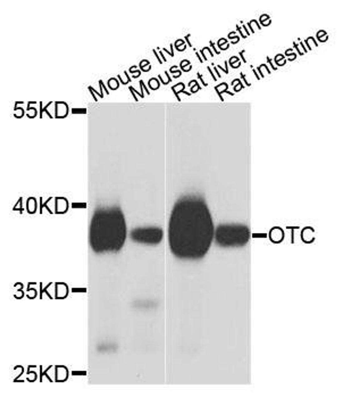 Western blot analysis of extracts of various cells using OTC antibody