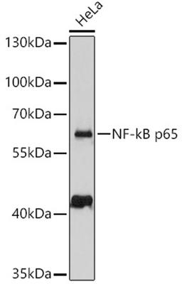 Western blot - NF-kB p65 antibody (A11201)