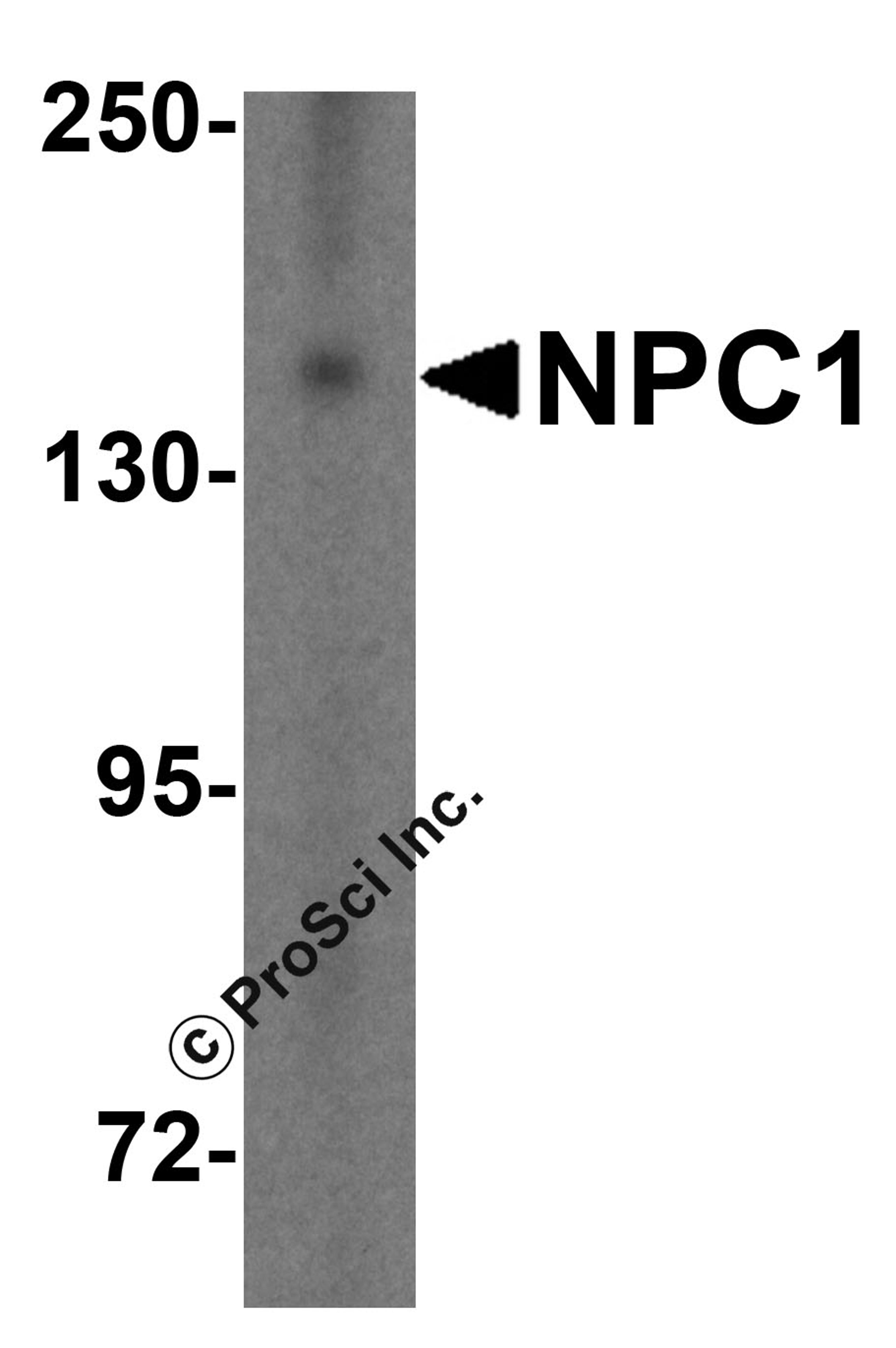 Western blot analysis of NPC1 in HepG2 cell lysate with NPC1 antibody at 1 &#956;g/mL.