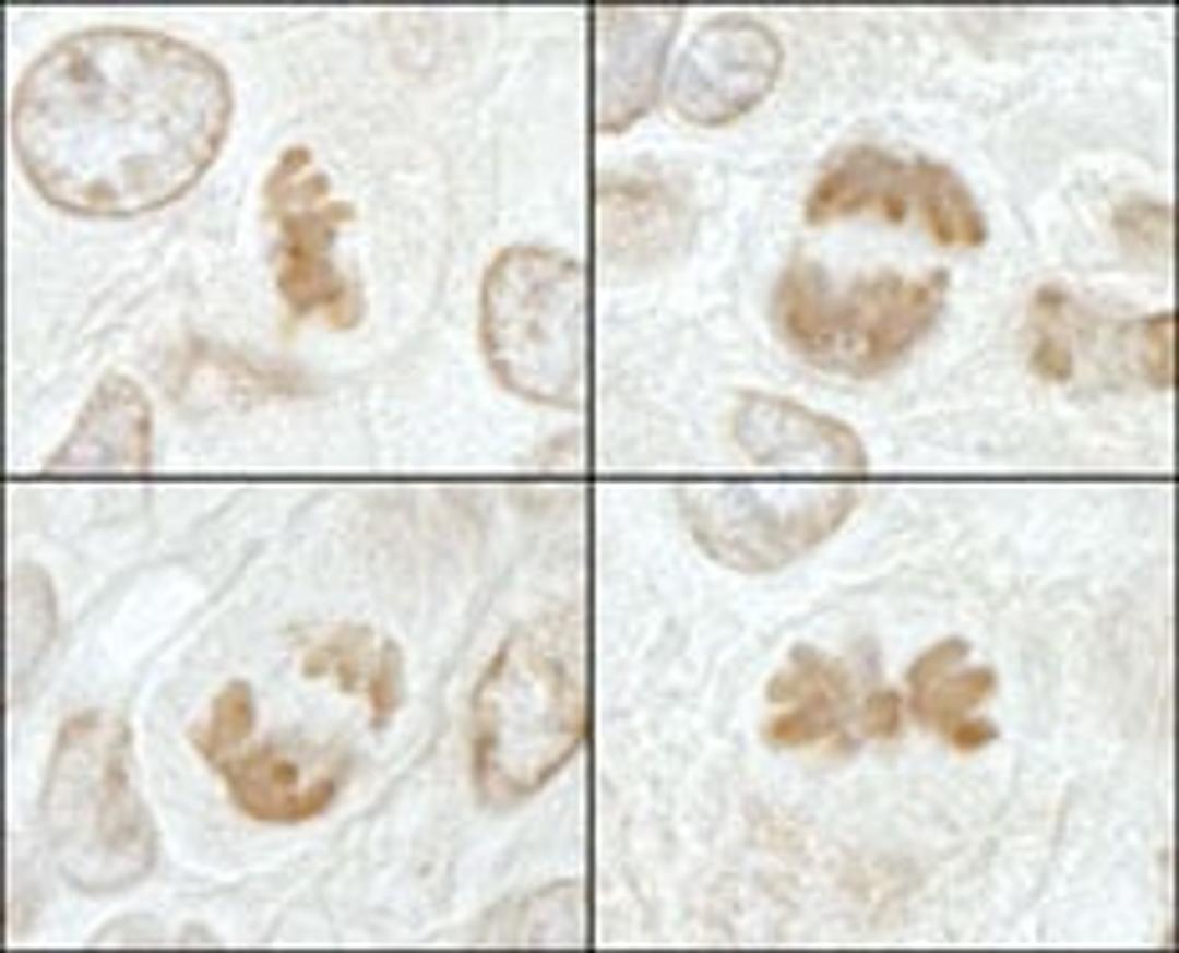 Detection of mouse MCAK by immunohistochemistry.