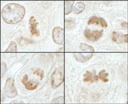 Detection of mouse MCAK by immunohistochemistry.