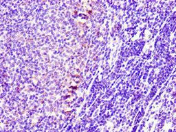 Immunohistochemistry of paraffin-embedded human lymph node tissue using CSB-PA022857LA01HU at dilution of 1:100
