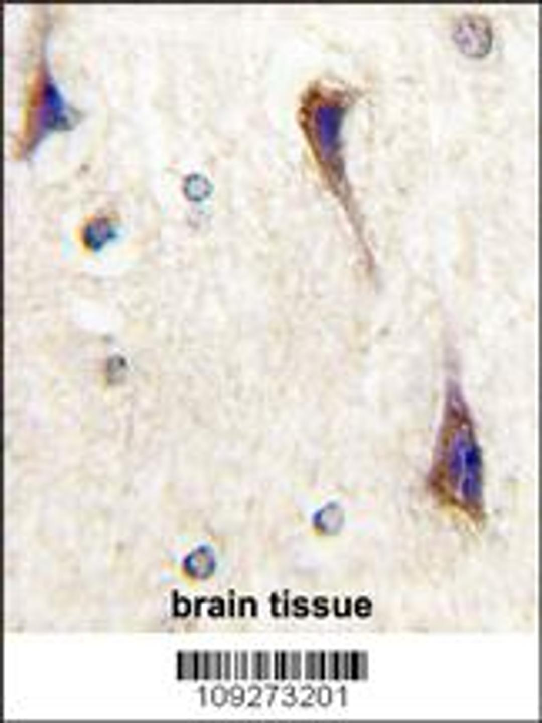 Formalin-fixed and paraffin-embedded human brain tissue reacted with CDK5R1(p35) Antibody , which was peroxidase-conjugated to the secondary antibody, followed by DAB staining.