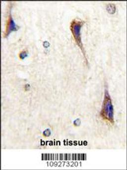 Formalin-fixed and paraffin-embedded human brain tissue reacted with CDK5R1(p35) Antibody , which was peroxidase-conjugated to the secondary antibody, followed by DAB staining.