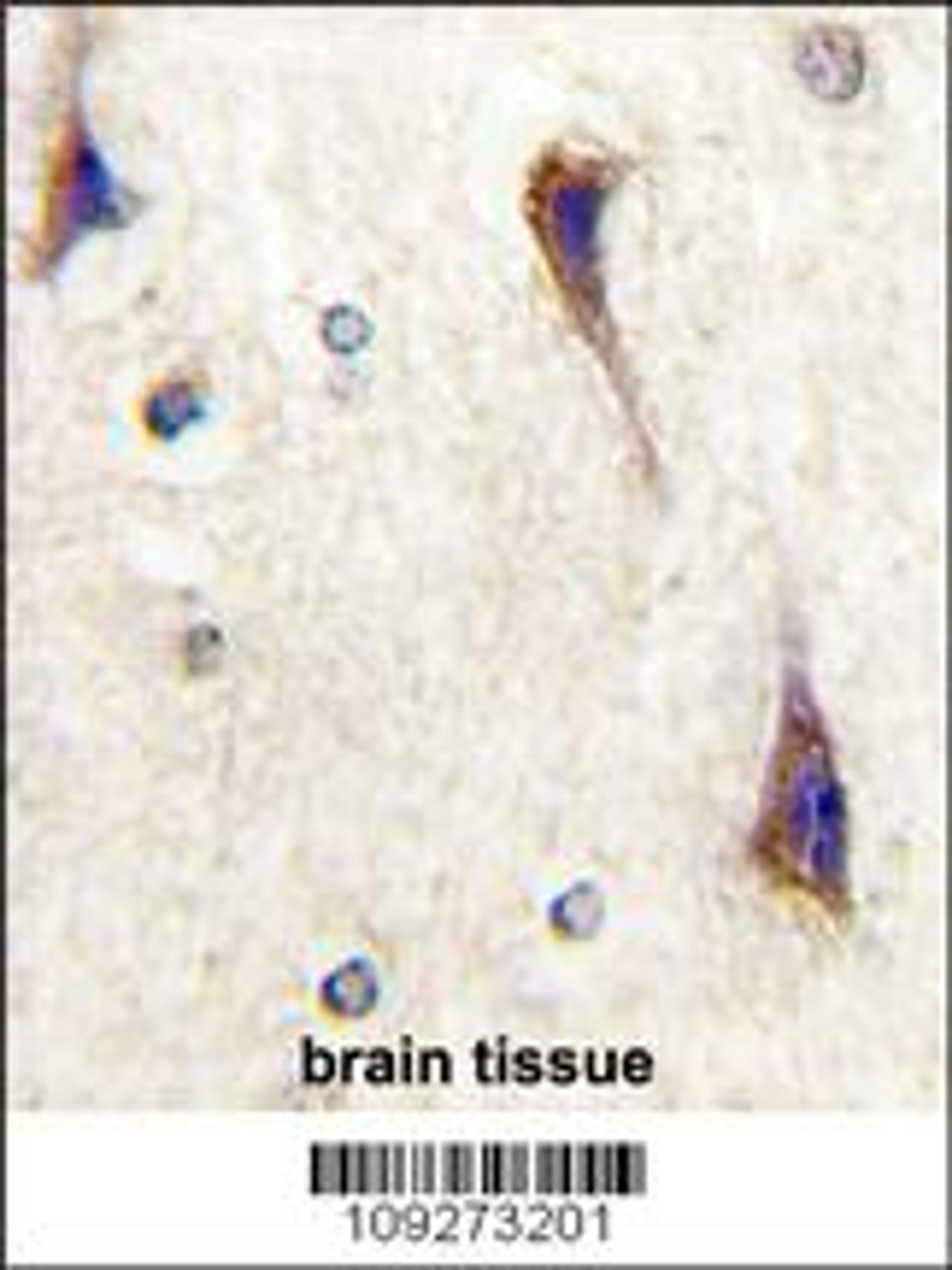 Formalin-fixed and paraffin-embedded human brain tissue reacted with CDK5R1(p35) Antibody , which was peroxidase-conjugated to the secondary antibody, followed by DAB staining.