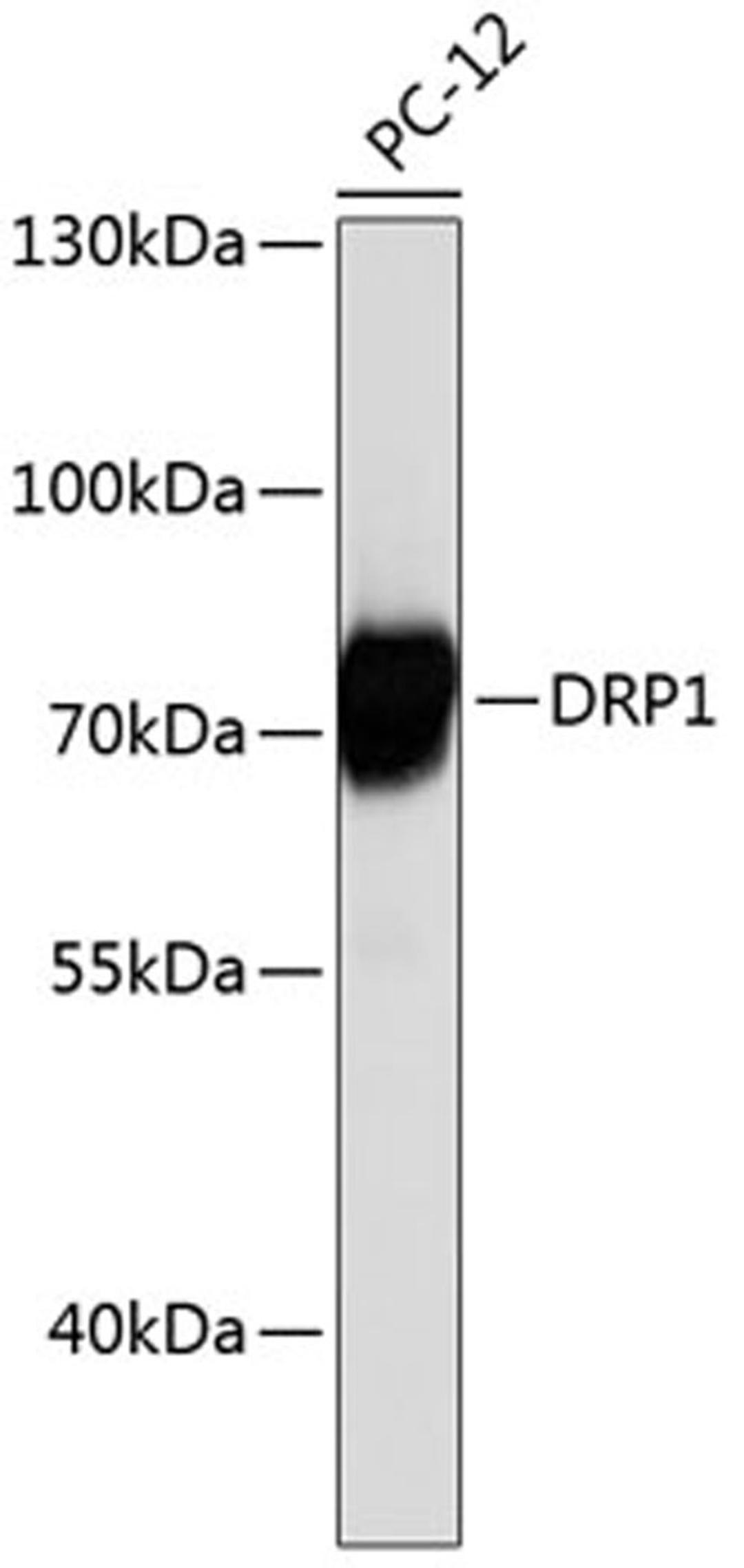 Western blot - DRP1 antibody (A0650)