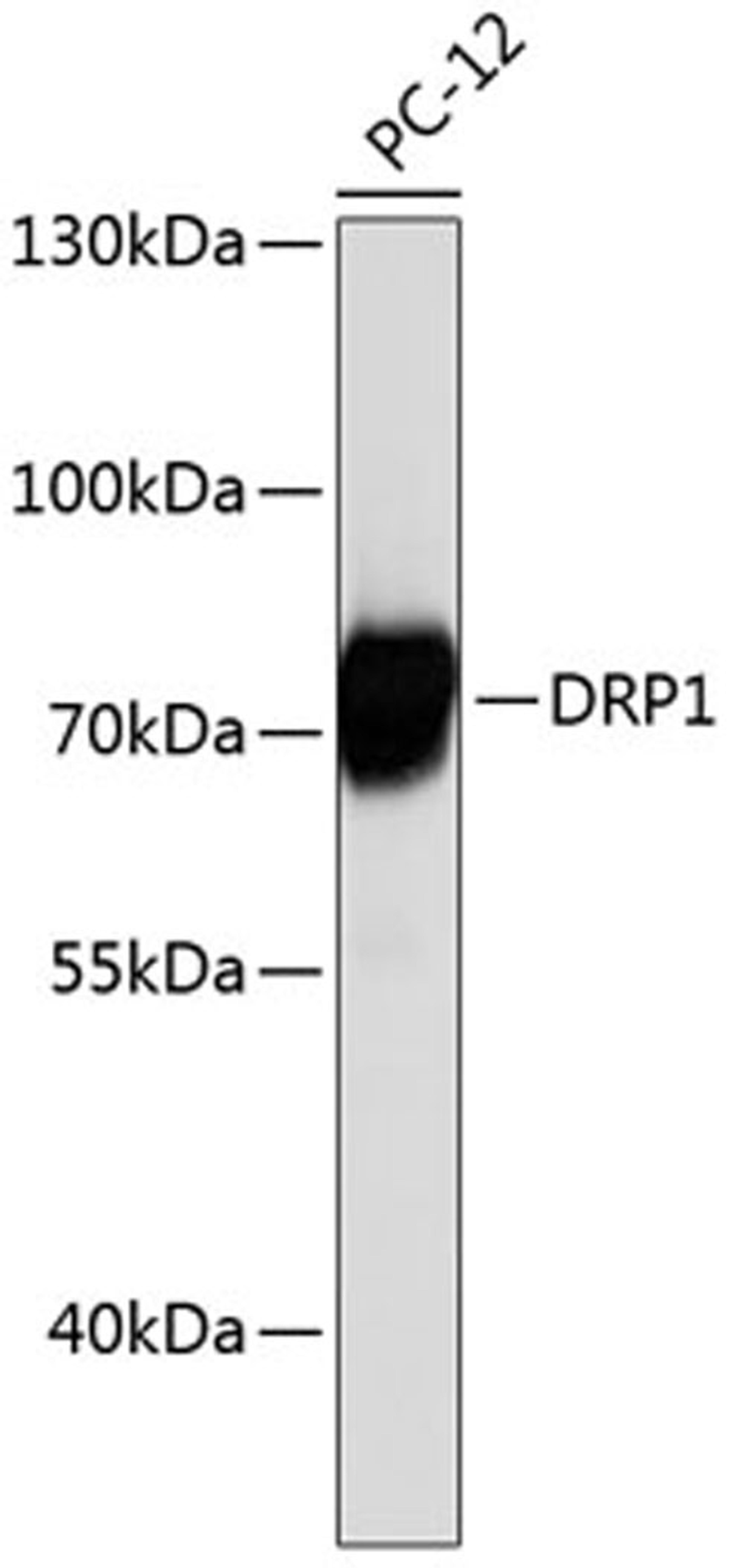 Western blot - DRP1 antibody (A0650)