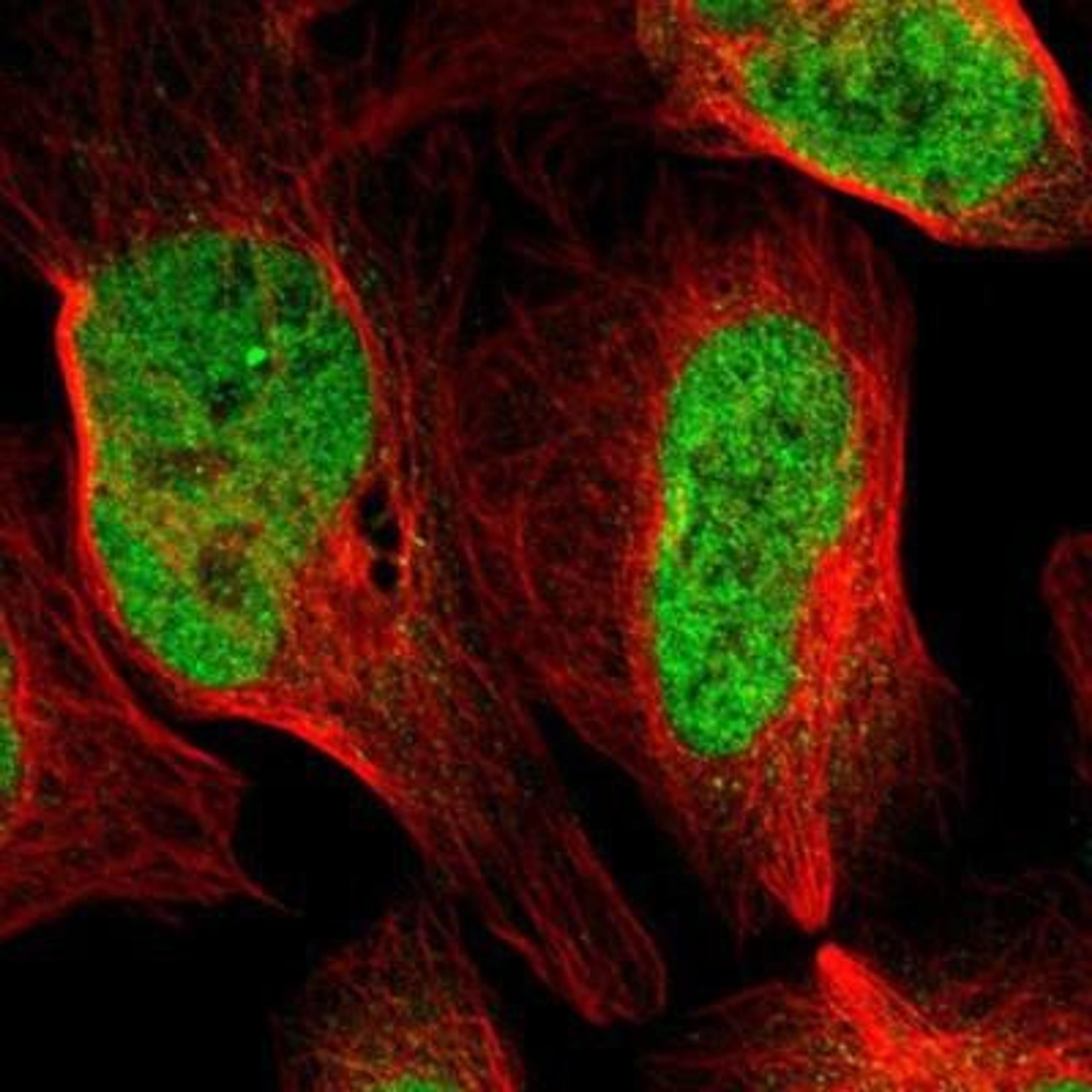 Immunocytochemistry/Immunofluorescence: ARID1A Antibody [NBP1-88932] - Staining of human cell line U-2 OS shows positivity in nucleus but not nucleoli.