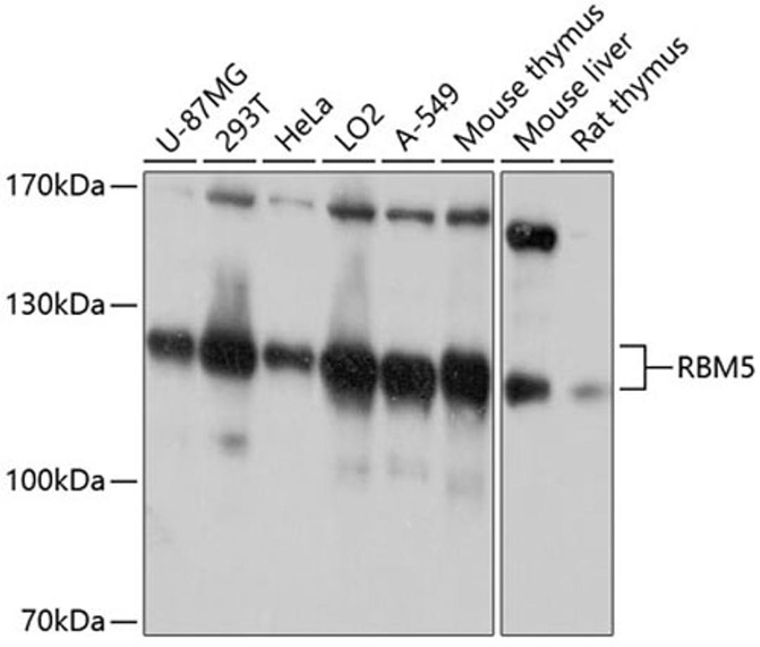 Western blot - RBM5 antibody (A10788)