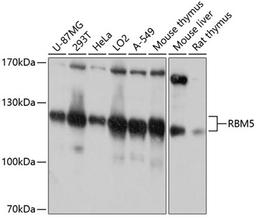 Western blot - RBM5 antibody (A10788)