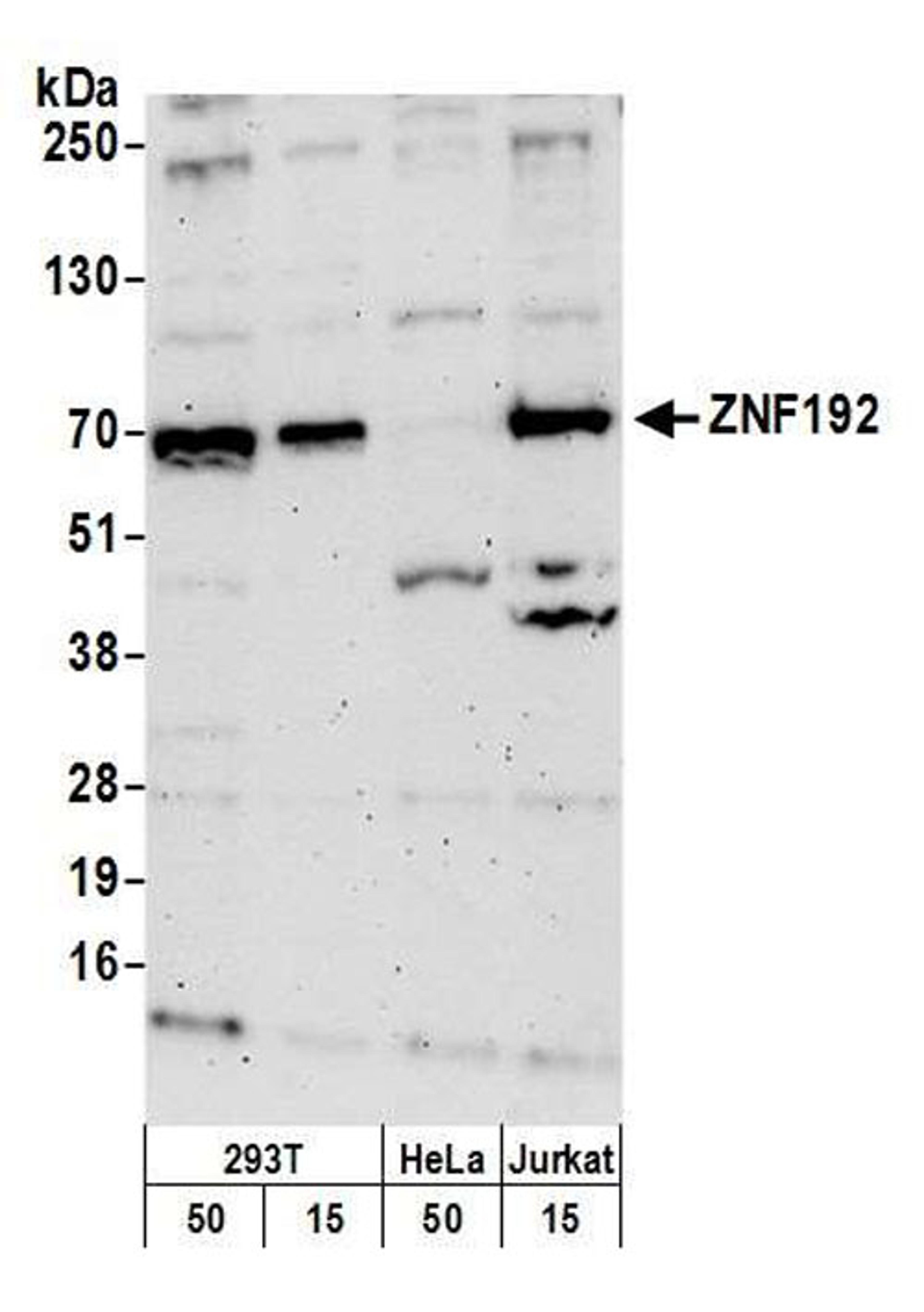 Detection of human ZNF192 by WB.