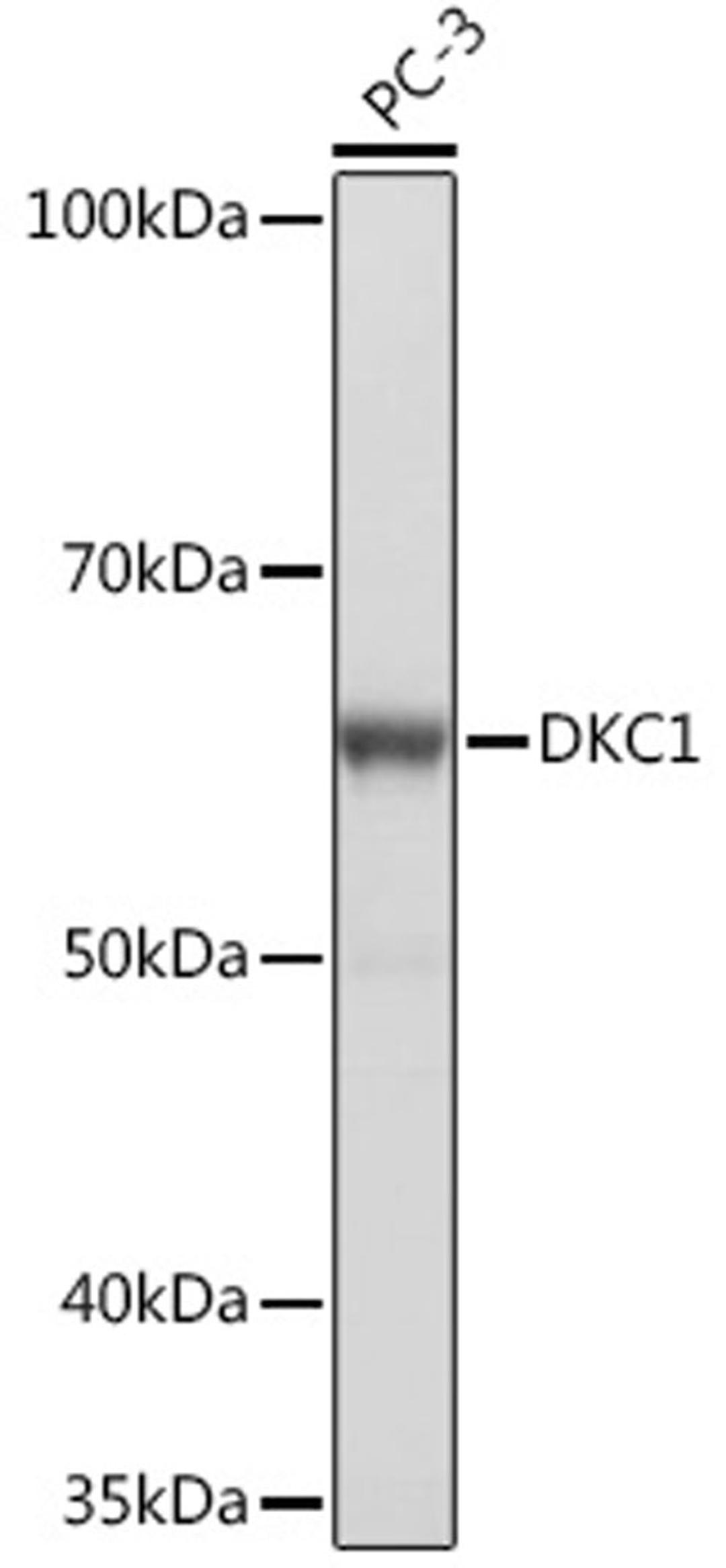 Western blot - DKC1 Rabbit mAb (A4407)