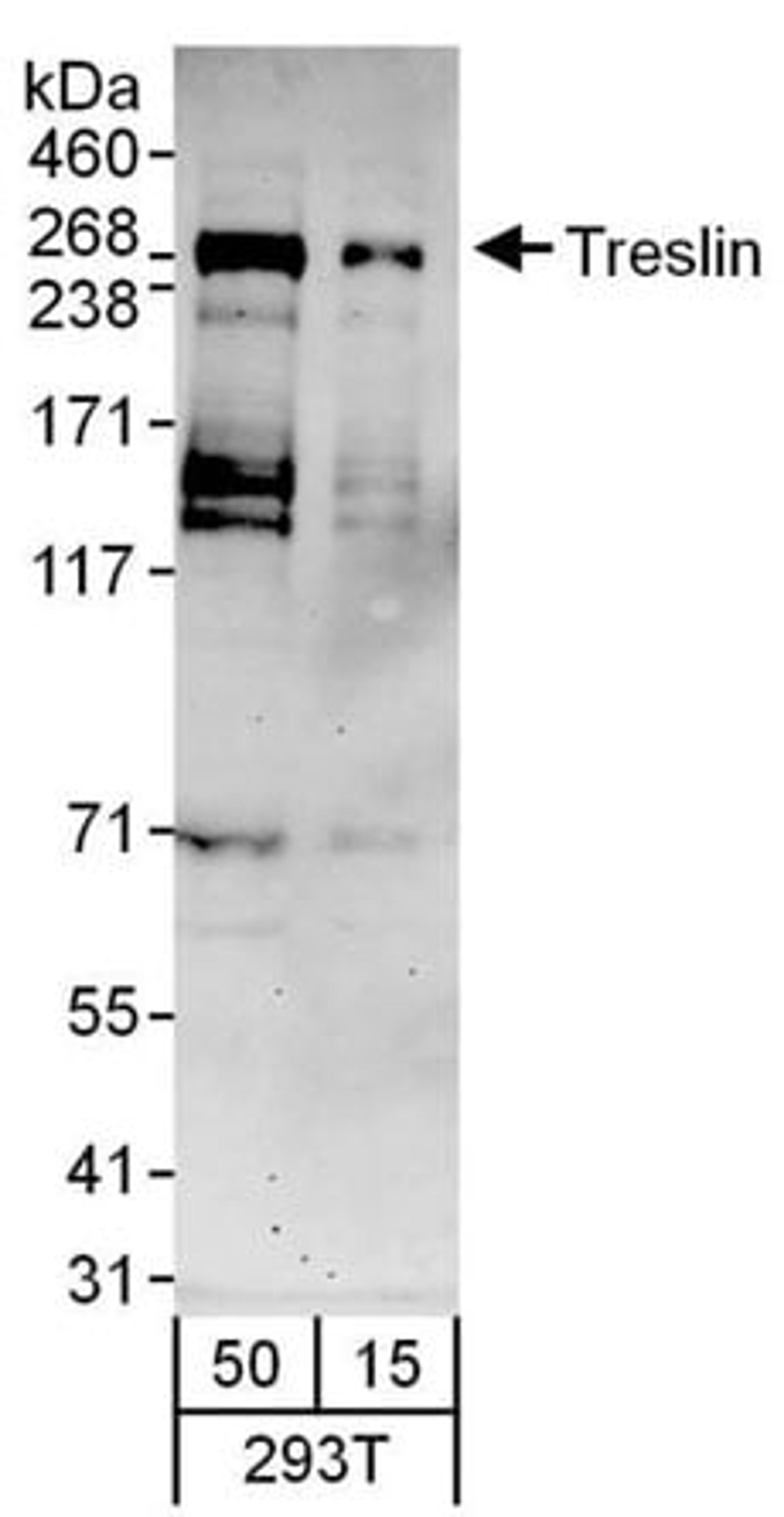 Detection of human Treslin by western blot.