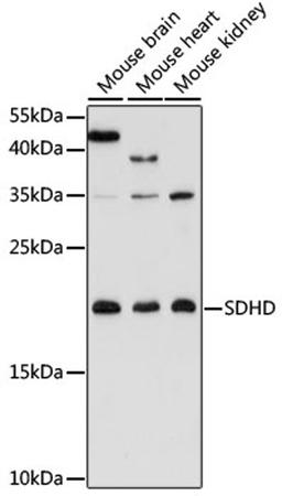 Western blot - SDHD antibody (A16240)