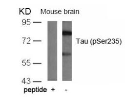 Western blot analysis of lysed extracts from mouse brain tissue using Tau (Phospho-Ser235).