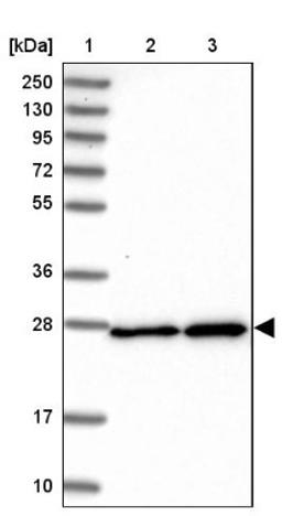 Western Blot: SPC25 Antibody [NBP2-47263] - Lane 1: Marker [kDa] 250, 130, 95, 72, 55, 36, 28, 17, 10.  Lane 2: Human cell line RT-4.  Lane 3: Human cell line U-251MG.