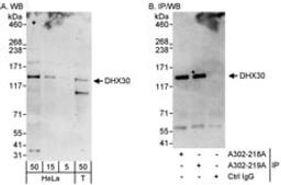 Detection of human DHX30 by western blot and immunoprecipitation.