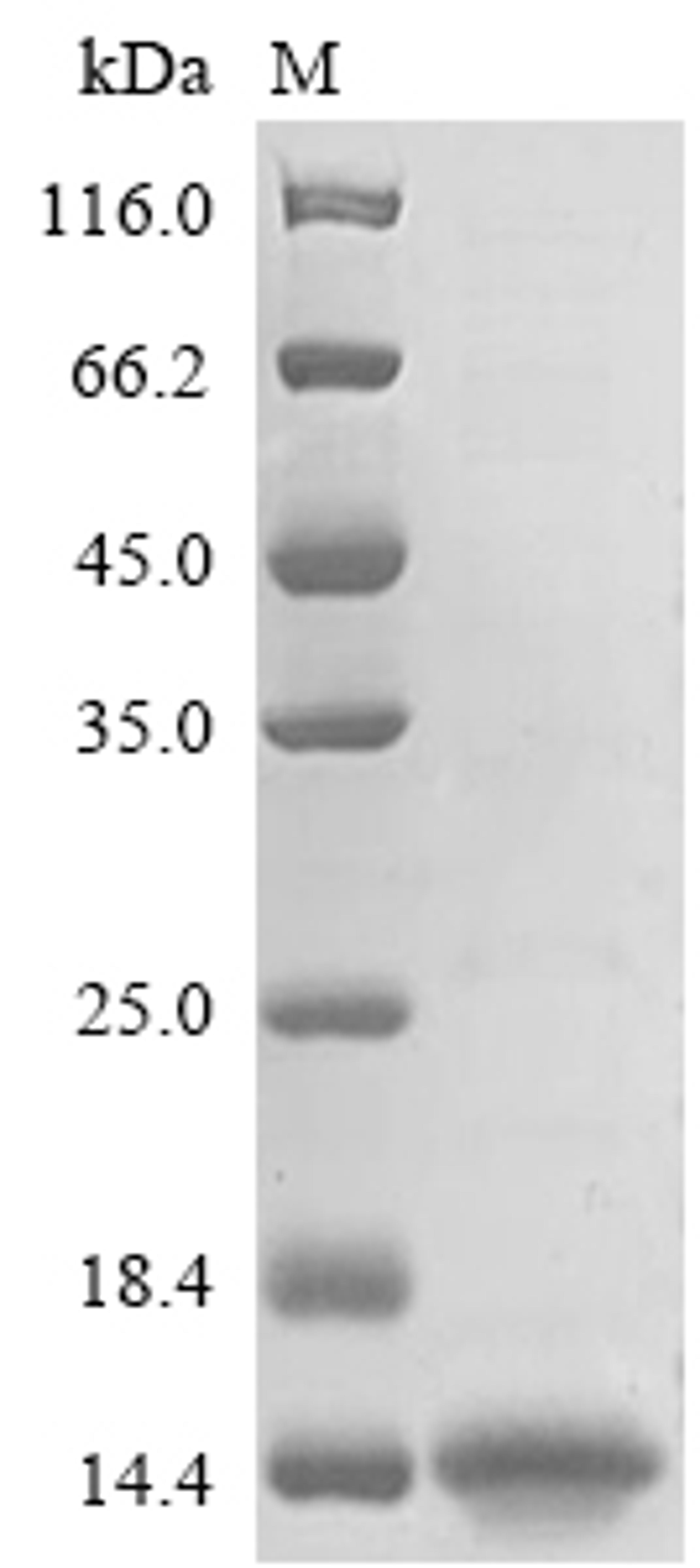 (Tris-Glycine gel) Discontinuous SDS-PAGE (reduced) with 5% enrichment gel and 15% separation gel.