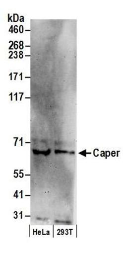 Detection of human Caper by western blot.