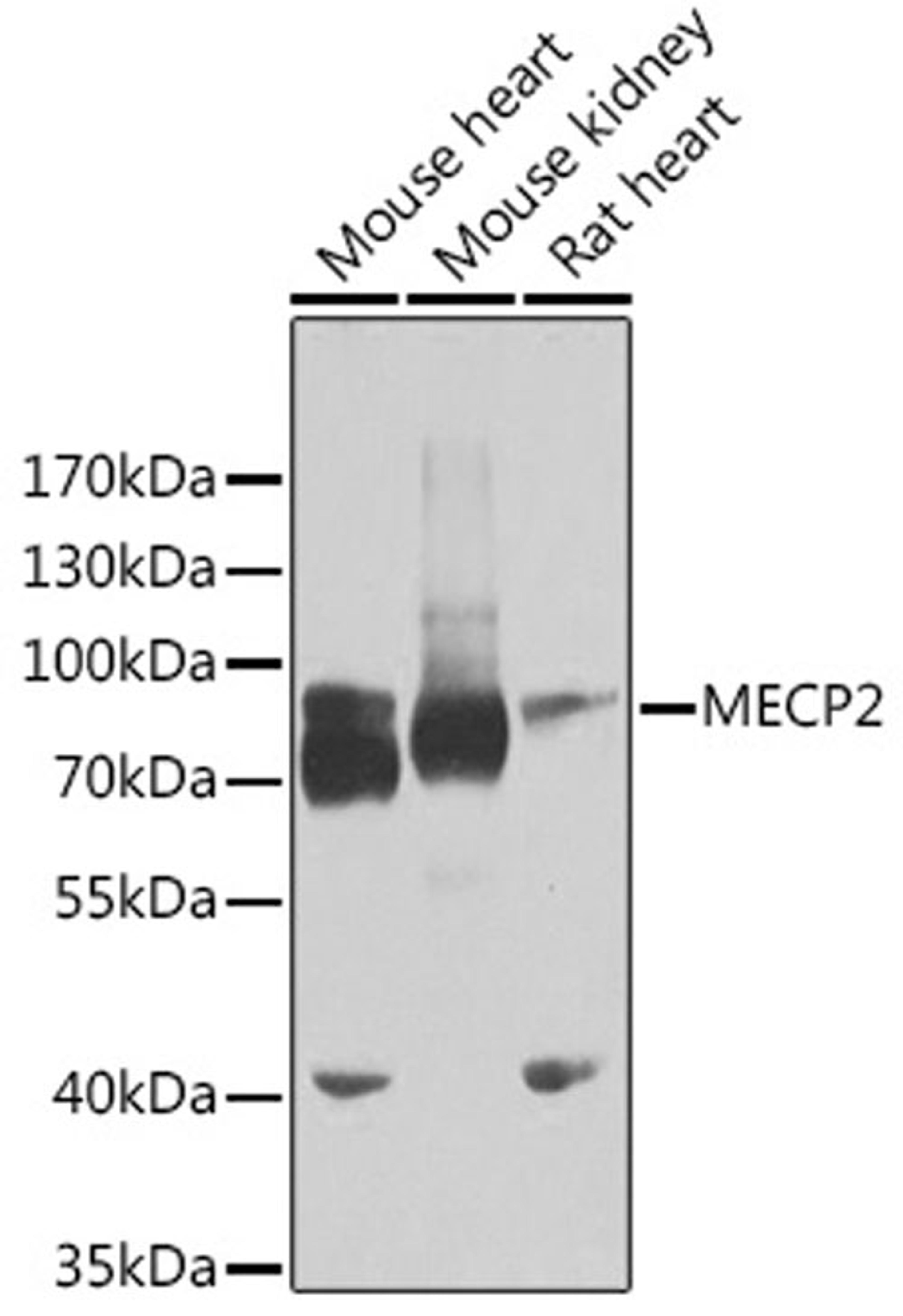 Western blot - MECP2 antibody (A5694)