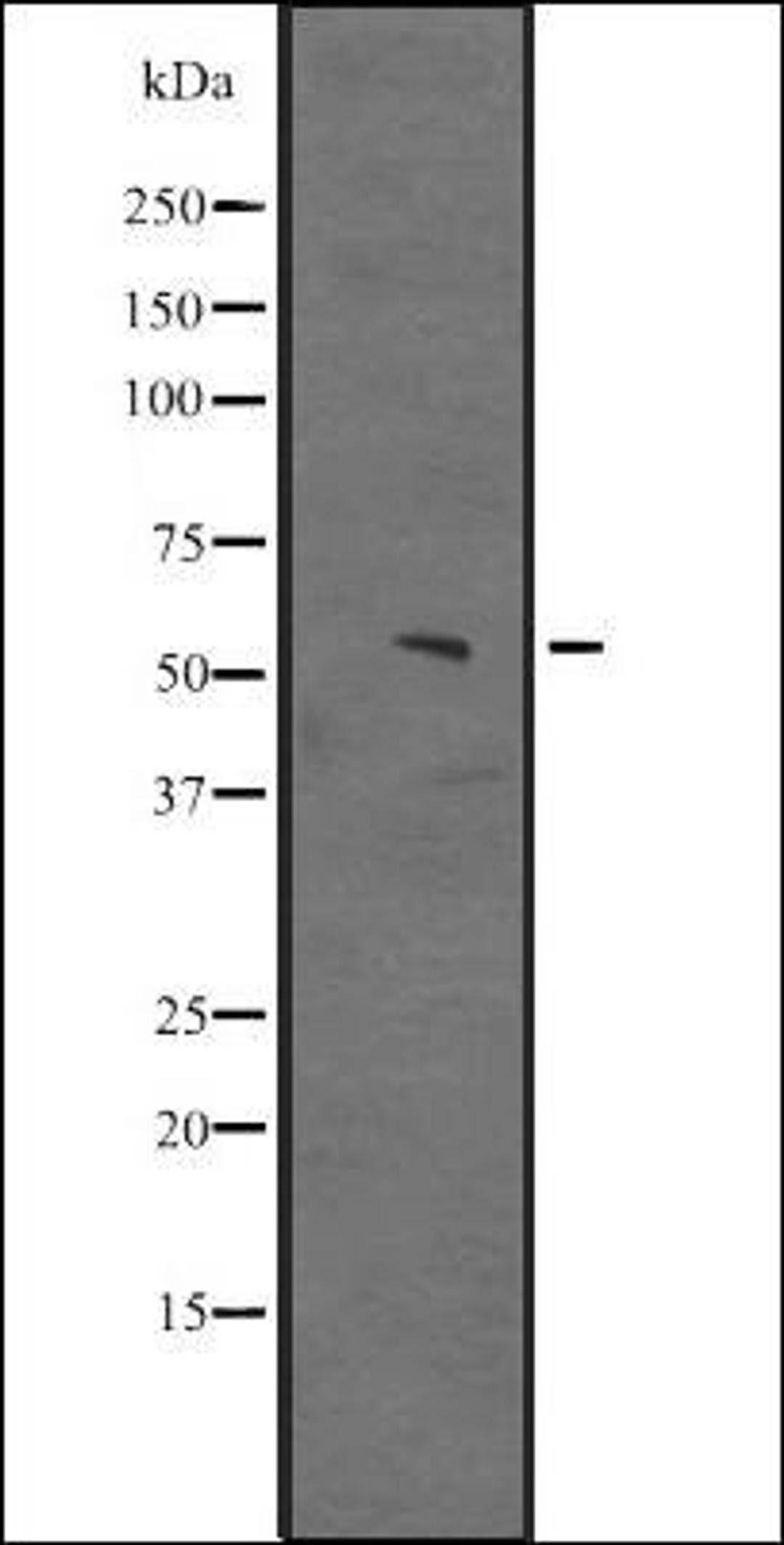 Western blot analysis of Hela cell lysate using JHD3D antibody