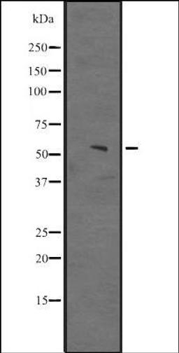 Western blot analysis of Hela cell lysate using JHD3D antibody