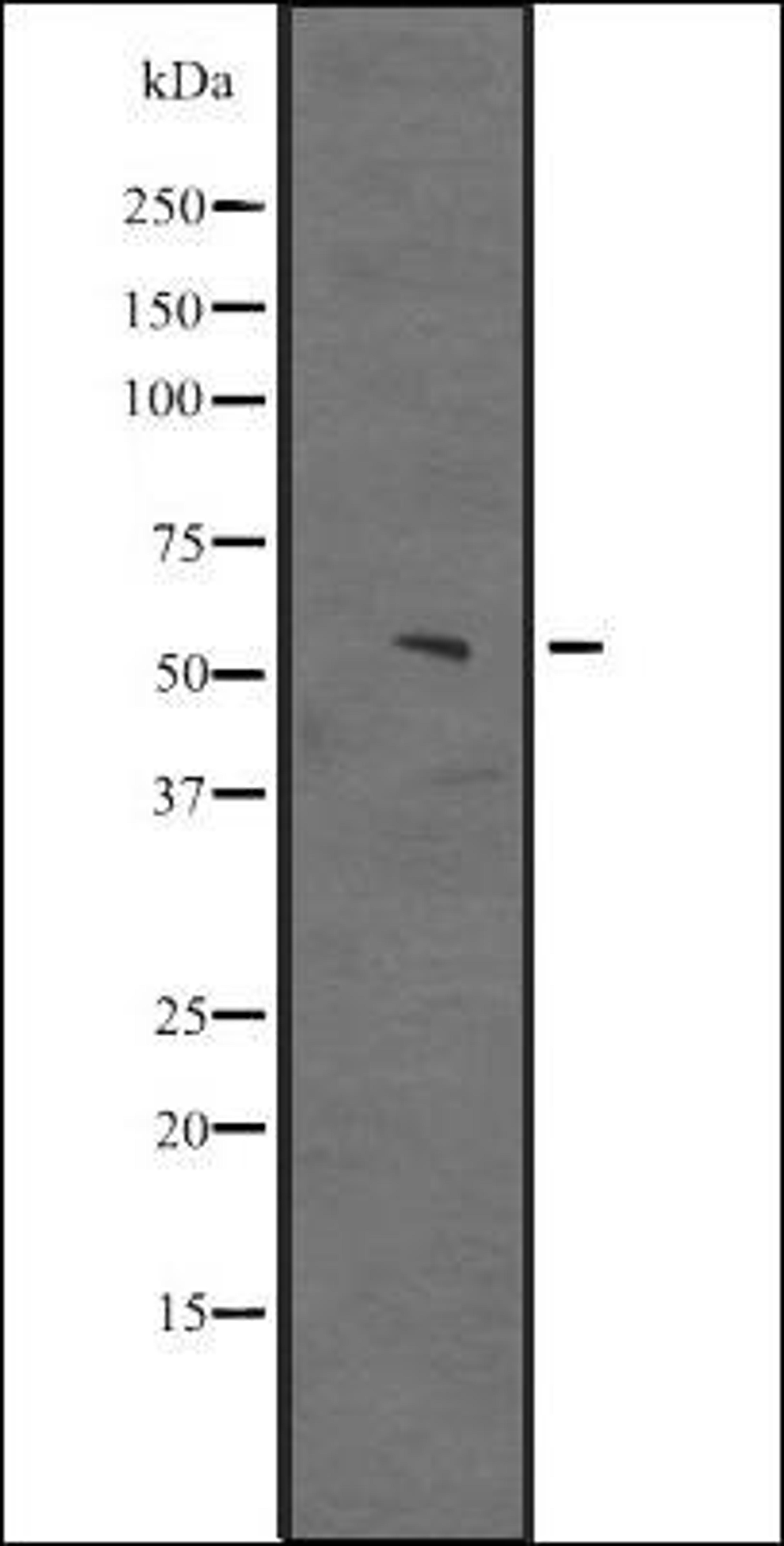 Western blot analysis of Hela cell lysate using JHD3D antibody