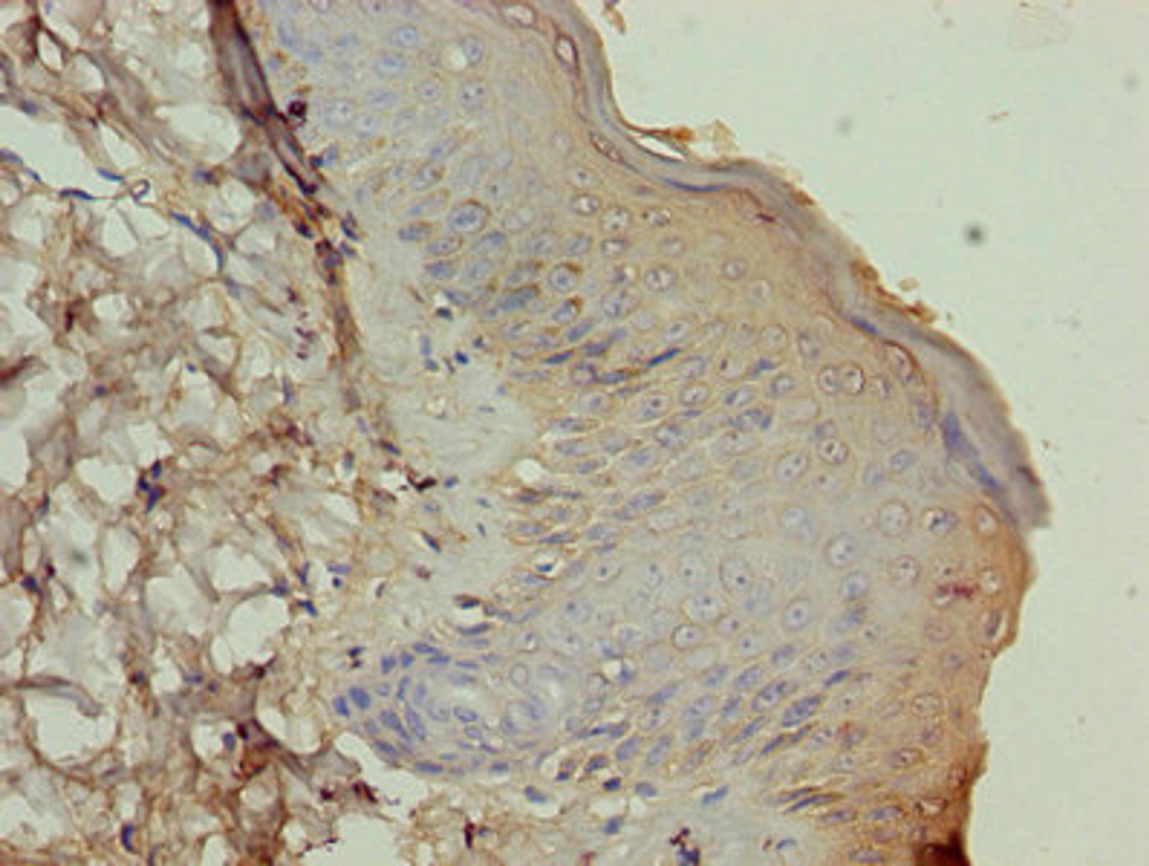 Immunohistochemistry of paraffin-embedded human skin tissue using CSB-PA002316LA01HU at dilution of 1:100