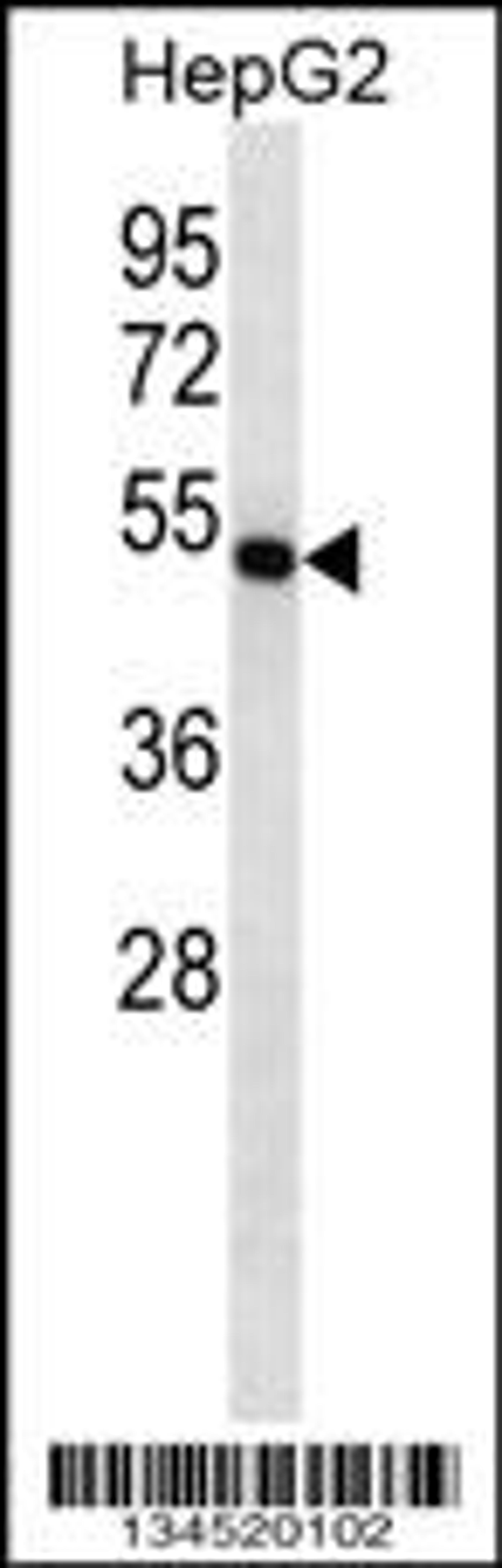 Western blot analysis in HepG2 cell line lysates (35ug/lane).