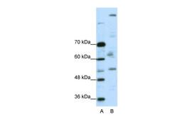 Antibody used in WB on Human A204 cells at 0.2-1 ug/ml.